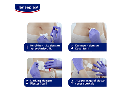 Hansaplast Sensitive XL Steps